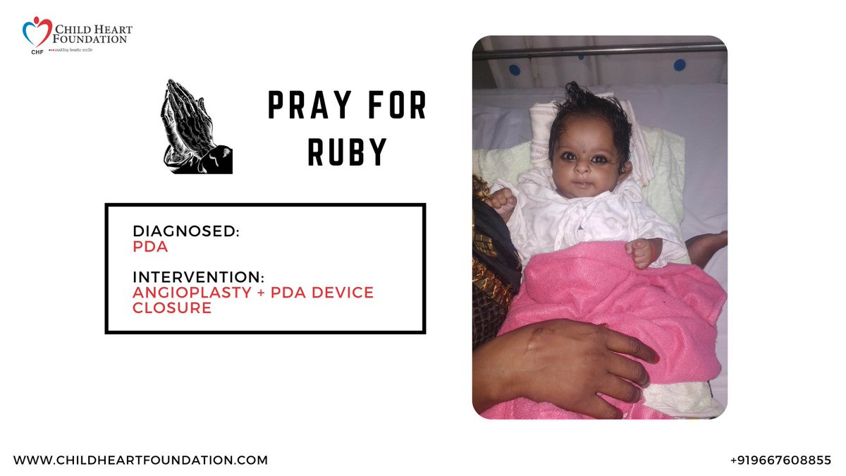 ChildHeartFndn's tweet photo. Please pray for 4-months-old Ruby, who is having her PDA Device closure today. #emergency #chd #pda #pdadeviceclosure #heartsurgery #hearttreatment #cardiacsurgery #friday #cardiacintervention #angioplasty #deviceclosure #chdwarrior #heartwarrior #chdwarrior #indiafightschd 🧵 https://t.co/99o7eJtxUo