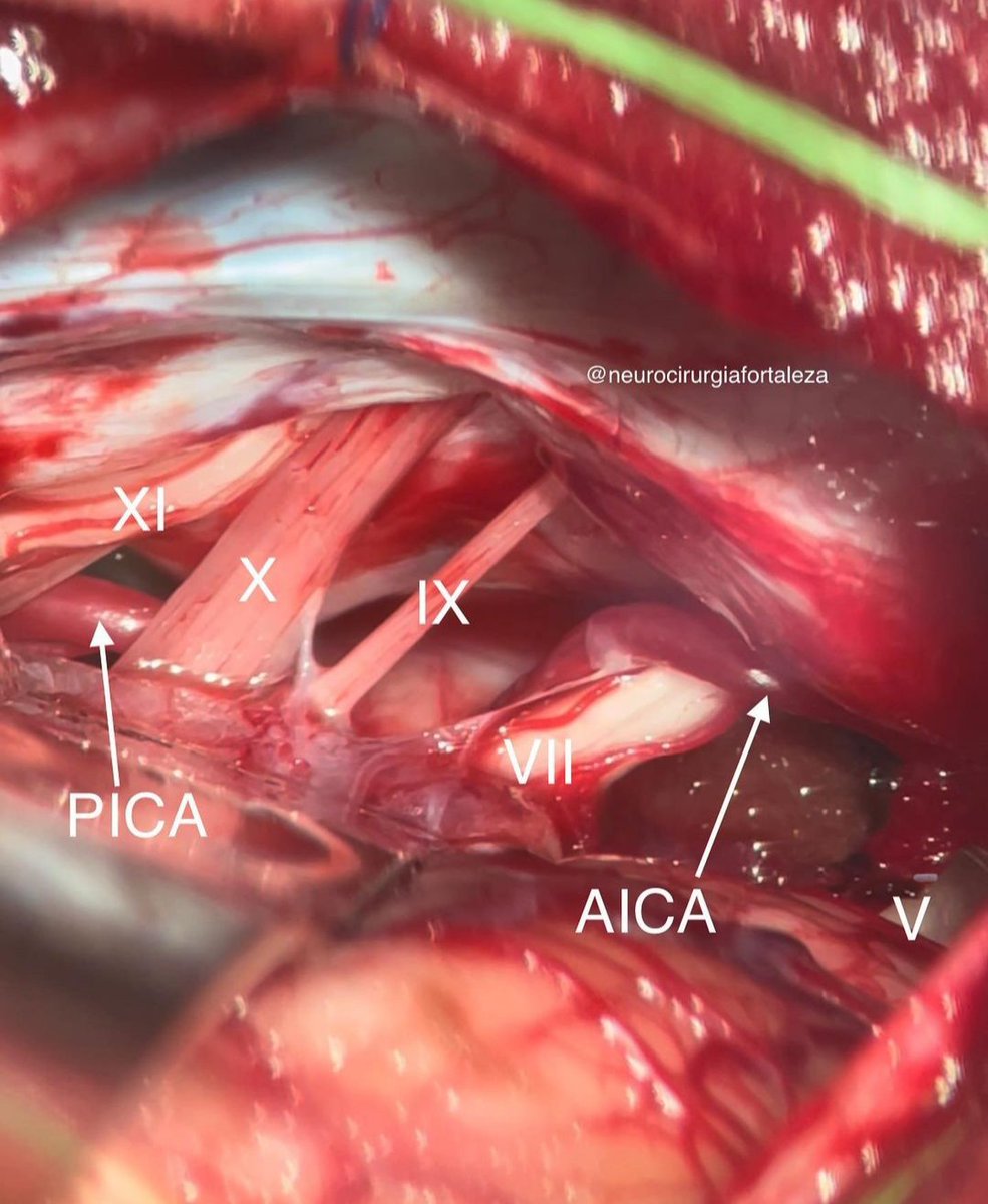 Neurosurgery Cocktail (@bipinchaurasia_) on Twitter photo 