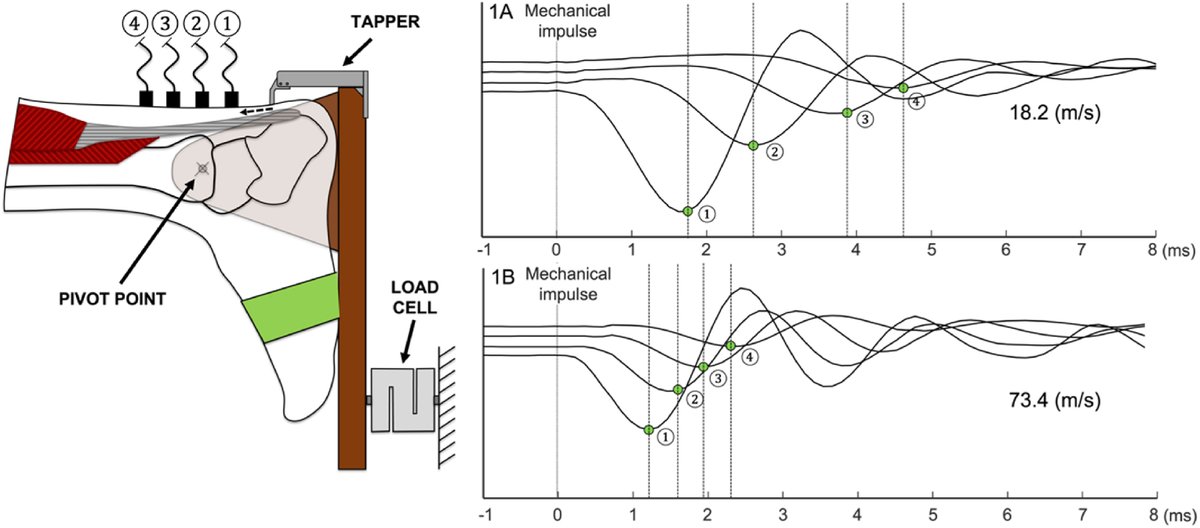 AlessandroSchneebeli (@aleschnee86) on Twitter photo A very promising technology for the measurement of Achilles tendon loading.
doi.org/10.1016/j.msks…
Thanks <a href="/Deb_Falla/">Deborah Falla</a> <a href="/MarcoBarberoFT/">Marco Barbero</a> <a href="/CorradoCescon/">Corrado Cescon 💎</a> <a href="/CprSpine/">CPR Spine</a> <a href="/supsi_2rlab/">SUPSI Laboratorio ricerca riabilitazione 2rLab</a> A very promising technology for the measurement of Achilles tendon loading.
doi.org/10.1016/j.msks…
Thanks <a href="/Deb_Falla/">Deborah Falla</a> <a href="/MarcoBarberoFT/">Marco Barbero</a> <a href="/CorradoCescon/">Corrado Cescon 💎</a> <a href="/CprSpine/">CPR Spine</a> <a href="/supsi_2rlab/">SUPSI Laboratorio ricerca riabilitazione 2rLab</a>