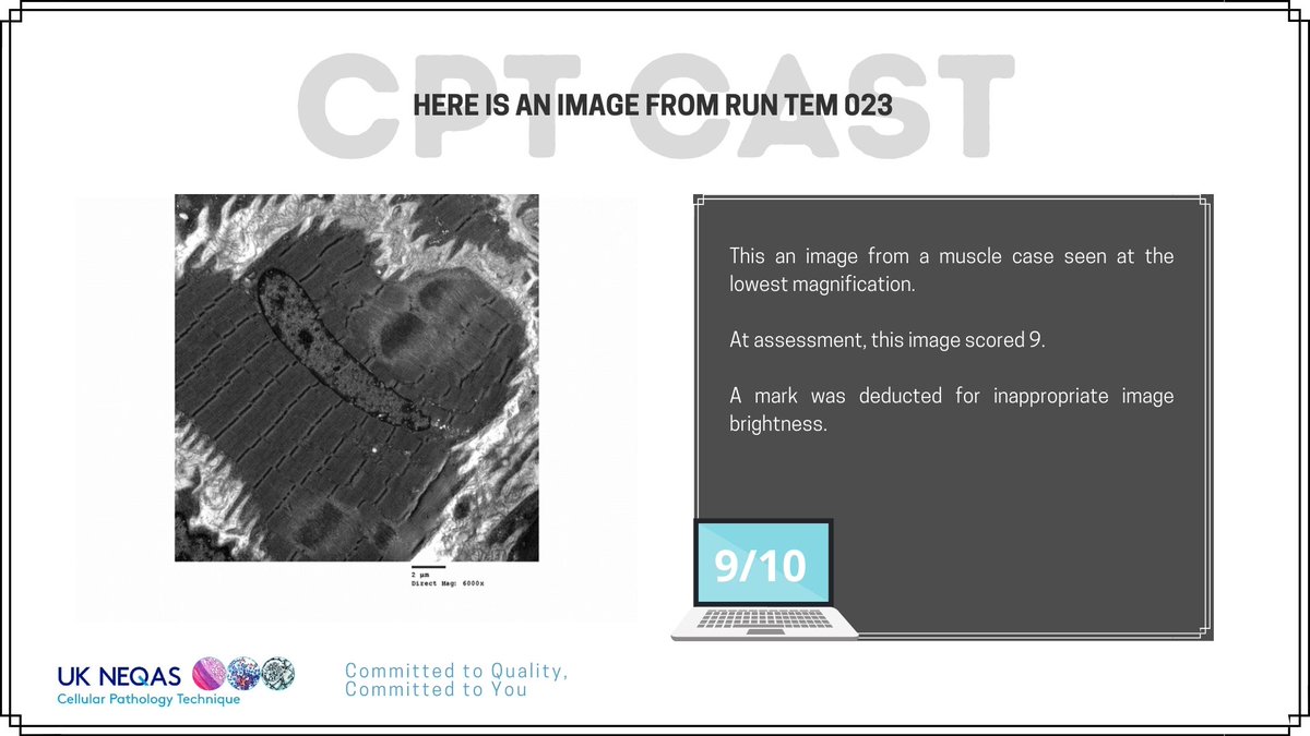 ukneqascpt's tweet image. What a brilliant score for this TEM submission which score 9/10 at assessment. Do you agree? 

#cptcast #transmissionelectonmicroscopy
#ukneqasTEMscheme
#cellularpathology
#ukneqascptassessment