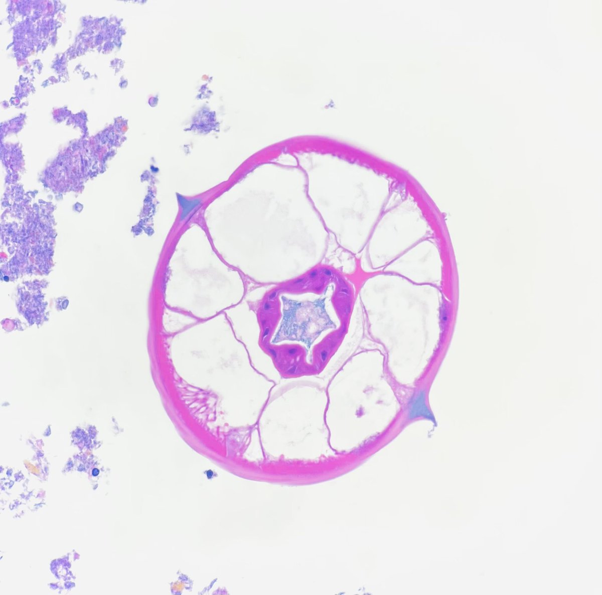 mattzaba1's tweet photo. Pregnant Pinworm🤰🤰
#Enterobius vermicularis https://t.co/xgl2QlEQpu