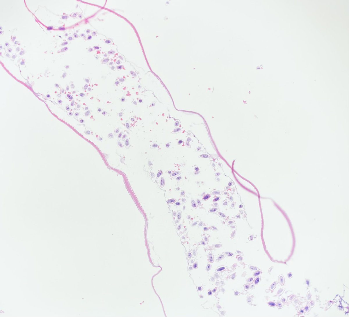 mattzaba1's tweet photo. Pregnant Pinworm🤰🤰
#Enterobius vermicularis https://t.co/xgl2QlEQpu