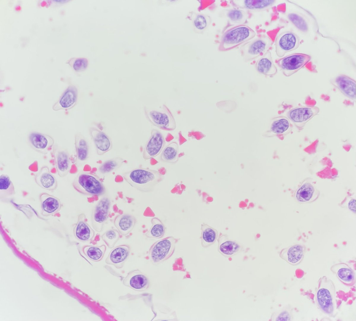 mattzaba1's tweet photo. Pregnant Pinworm🤰🤰
#Enterobius vermicularis https://t.co/xgl2QlEQpu