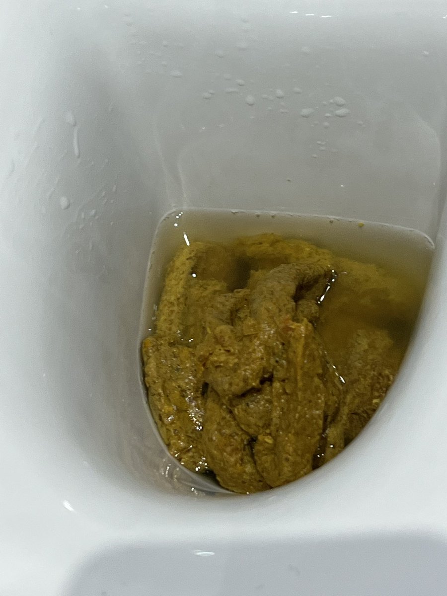 JapaneseGirlF's tweet photo. The best poops fill the bowl. ๐คญ๐ฉ #toilet #poop #pileofpoop #shitload https://t.co/jMJazecEmm