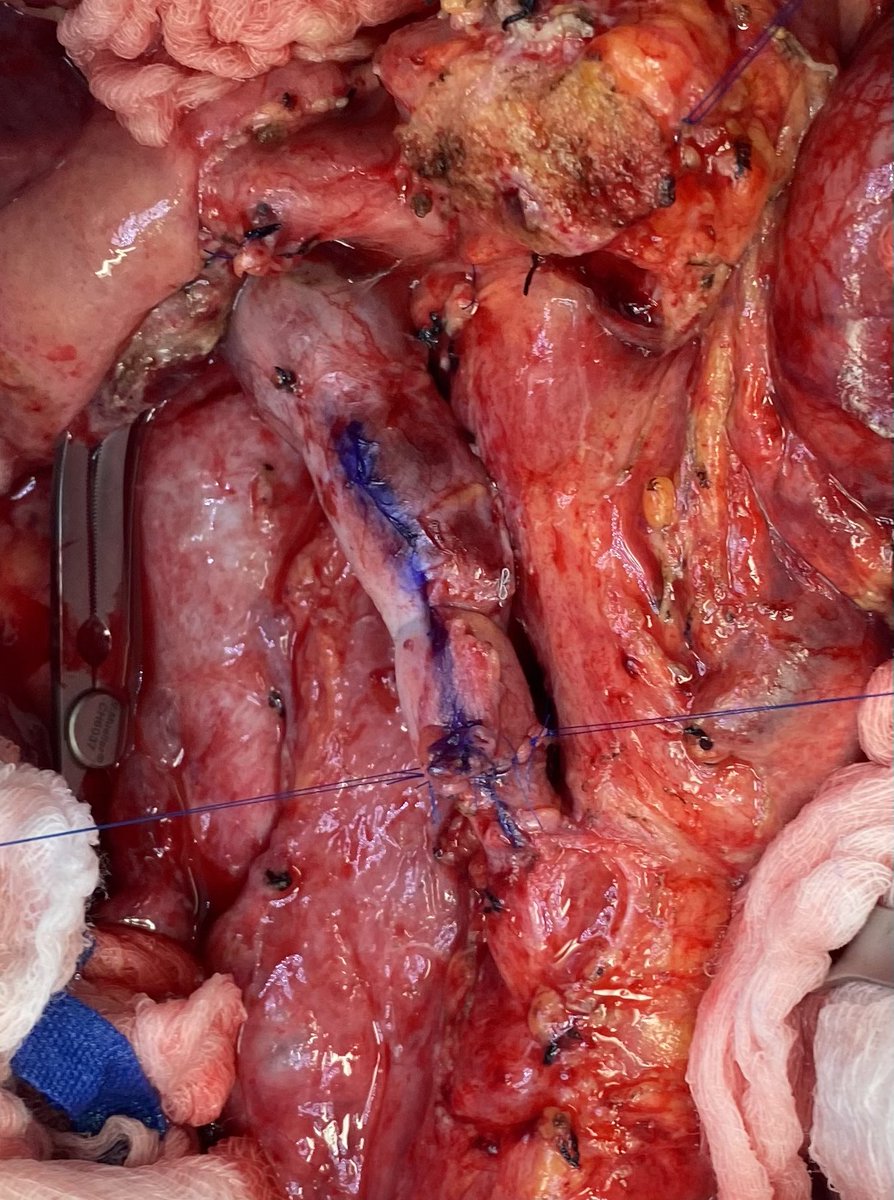 Jason W Denbo tweet media