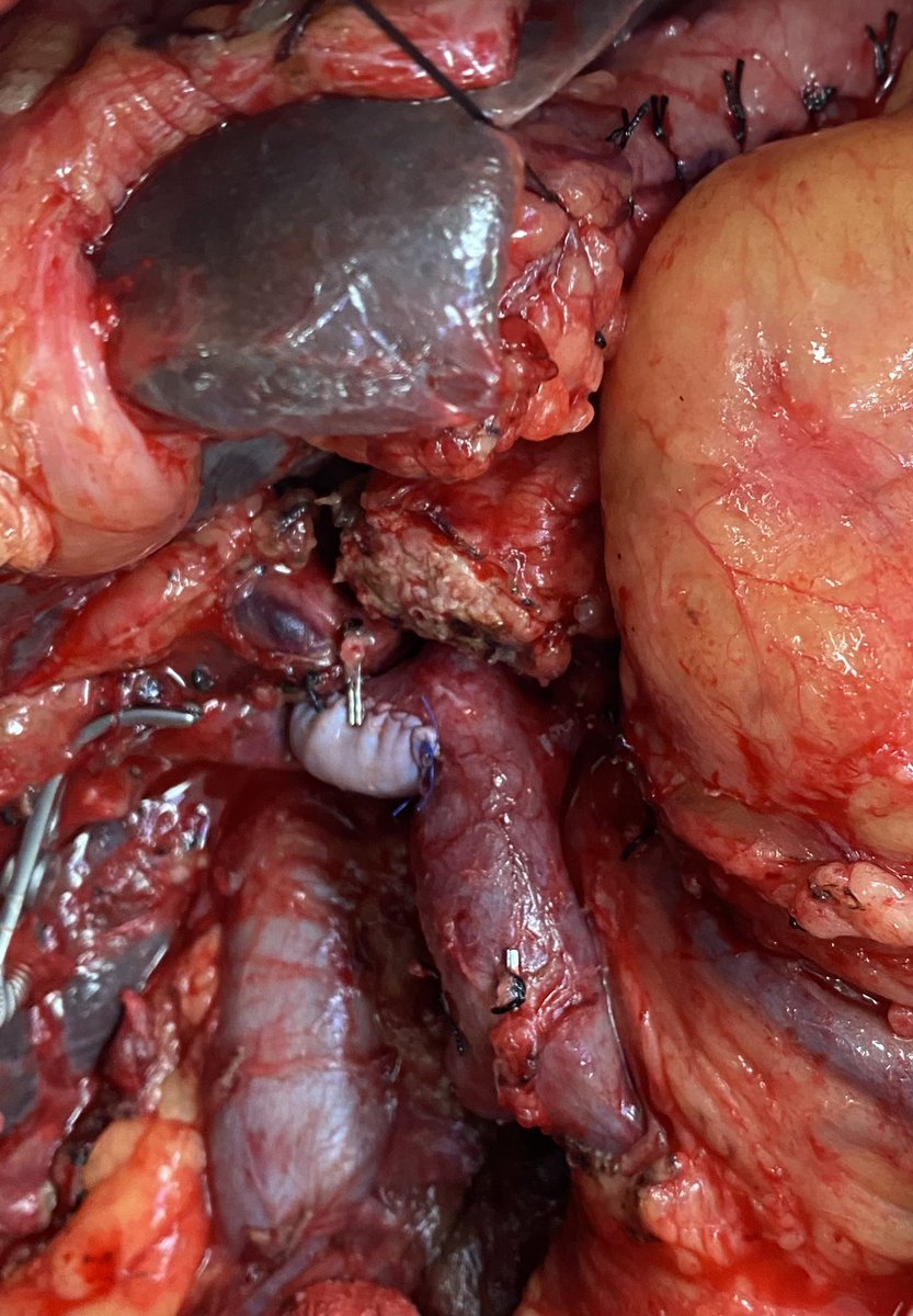 Jason W Denbo tweet media