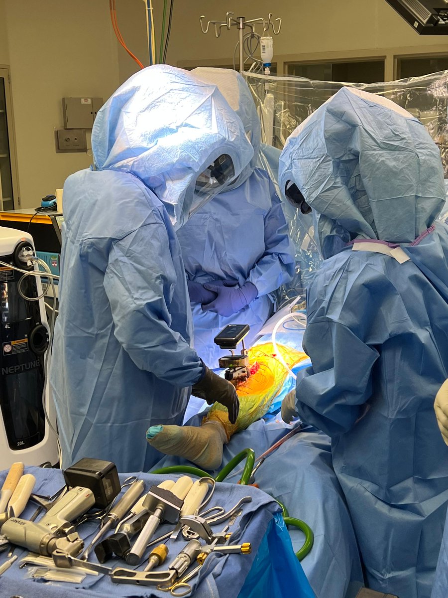 OrthAlign_Inc's tweet photo. Congratulations to @BradWaddellMD for completing his first revision total knee surgery using Lantern Balance!
 
Learn more about Lantern Balance: https://t.co/xfshPeyyKX
 
#orthalign #orthopedicsurgeon #revision #lantern #balance #lightupyouror https://t.co/EDSwSrVhfB