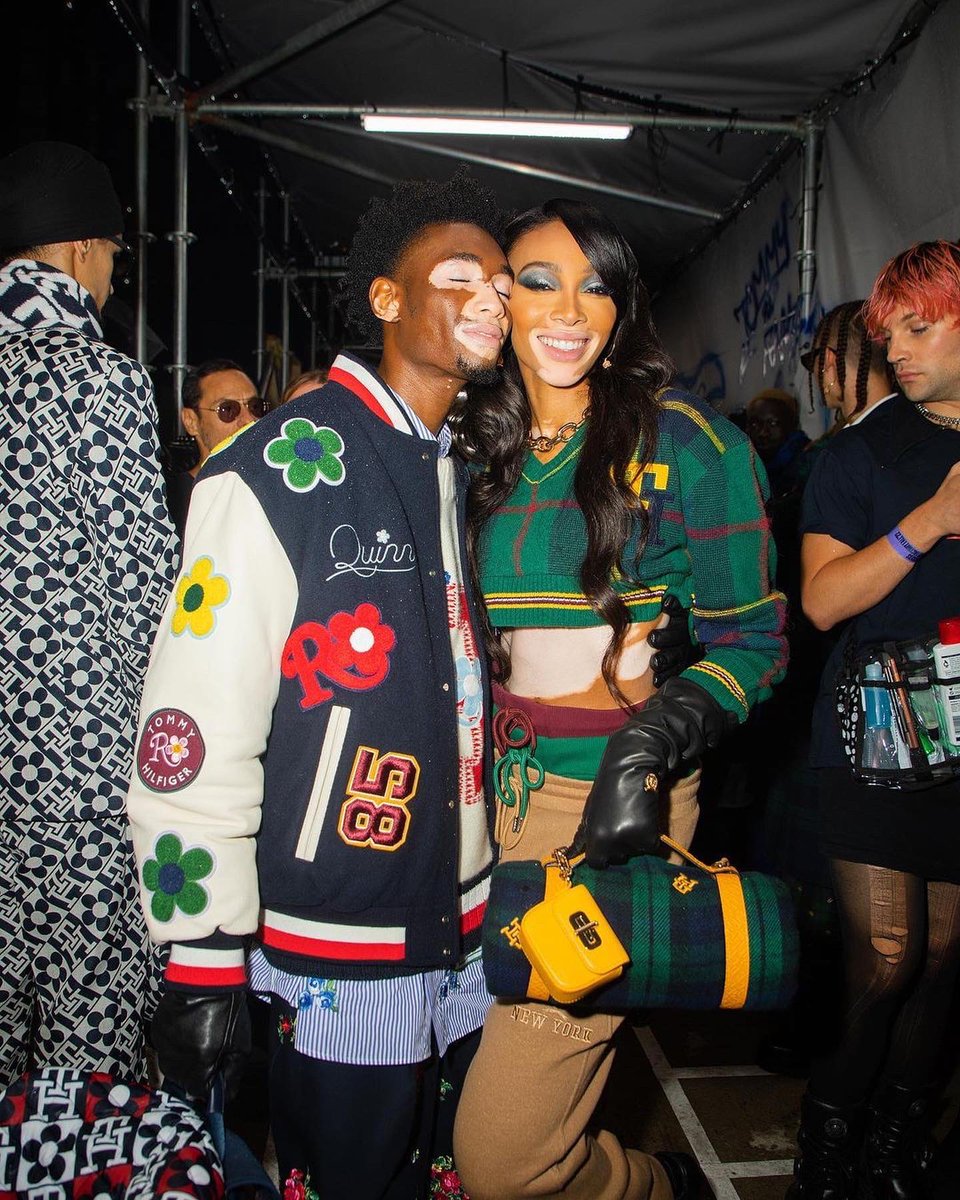 Representation Matters! ❤️ #Vitiligo  #TommyHilfigerXRichardQuinn