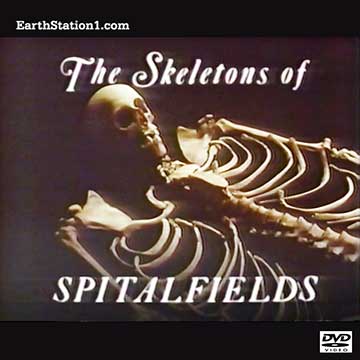MediaoutletCom's tweet photo. #NewRelease: The #SkeletonsOfSpitalfields #MP4 #VideoDownload #DVD 
https://t.co/ycfyBJ3O1s 
#ChristChurchSpitalfields #ChristChurch #Spitalfields #Archaelogy #Archeology #Anthropology #Medicine #Dentistry #Forensics #Halloween #Spooky #Scary #Boo! https://t.co/F3am841fpS