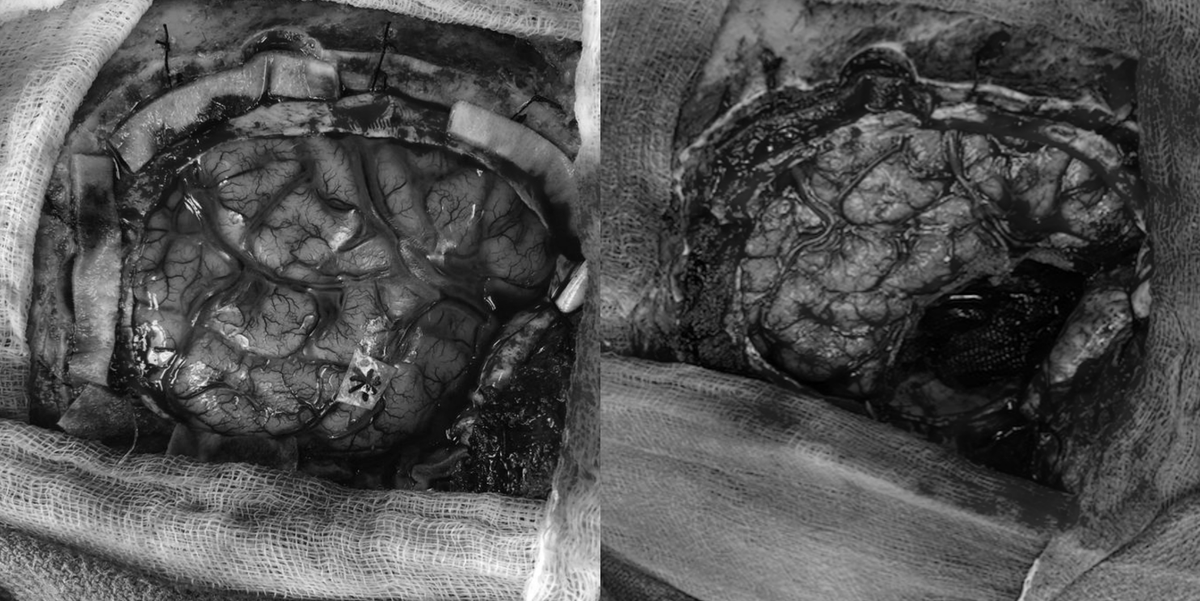 Jonathan C. Lau tweet media