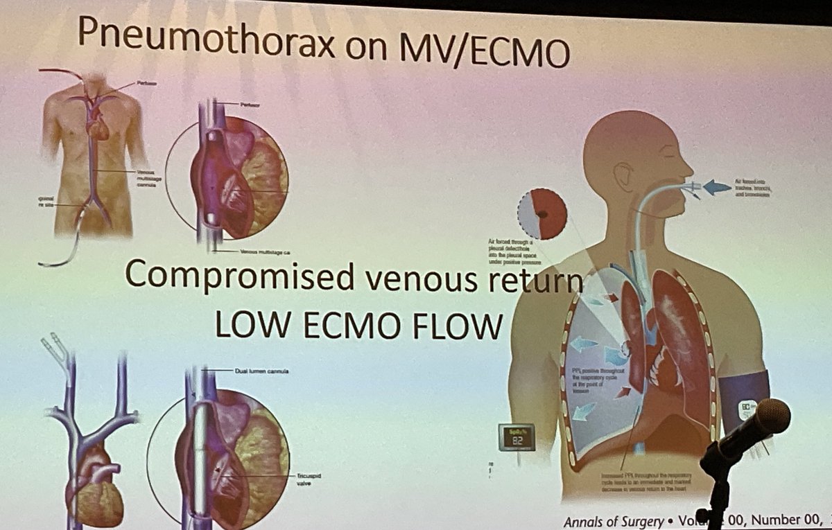 abribriesco43's tweet photo. #ELSO2022 @ELSOOrg
#ChestTube placement on #ECMO by #NathalieRoy from @BostonChildrens
#ECMO for management of #BPFs
@tssmn @CCF_CTSRes @TallRoundsTM @TSRA_official @AspiringCTS https://t.co/UZxprs67xR