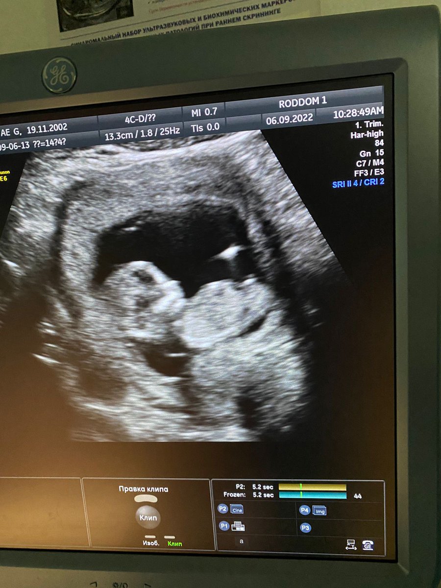 Я понял что самая безжалостная ложь в мире это "твой отец бросил нас" но очень поздно. 
Прости меня малыш.