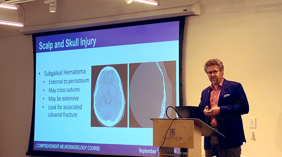 Judy Gadde, DO, MBA (@judygadde) on Twitter photo Brain Trauma, something we all probably see relatively commonly, made easy by <a href="/neurokinghippo/">Joshua Nickerson</a> at <a href="/TheASNR/">The American Society of Neuroradiology</a> #CNC22!
#radiology #RadEd Brain Trauma, something we all probably see relatively commonly, made easy by <a href="/neurokinghippo/">Joshua Nickerson</a> at <a href="/TheASNR/">The American Society of Neuroradiology</a> #CNC22!
#radiology #RadEd