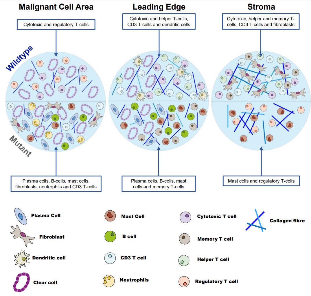 Online First: The tumor microenvironment of clear cell #ovariancancer, by @drmjdevlin, Frances R. Balkwill et al.
bit.ly/3diMMye
<a href="/FrancesBalkwill/">Frances Balkwill</a> <a href="/DrDaleGarsed/">Dr Dale Garsed</a>
