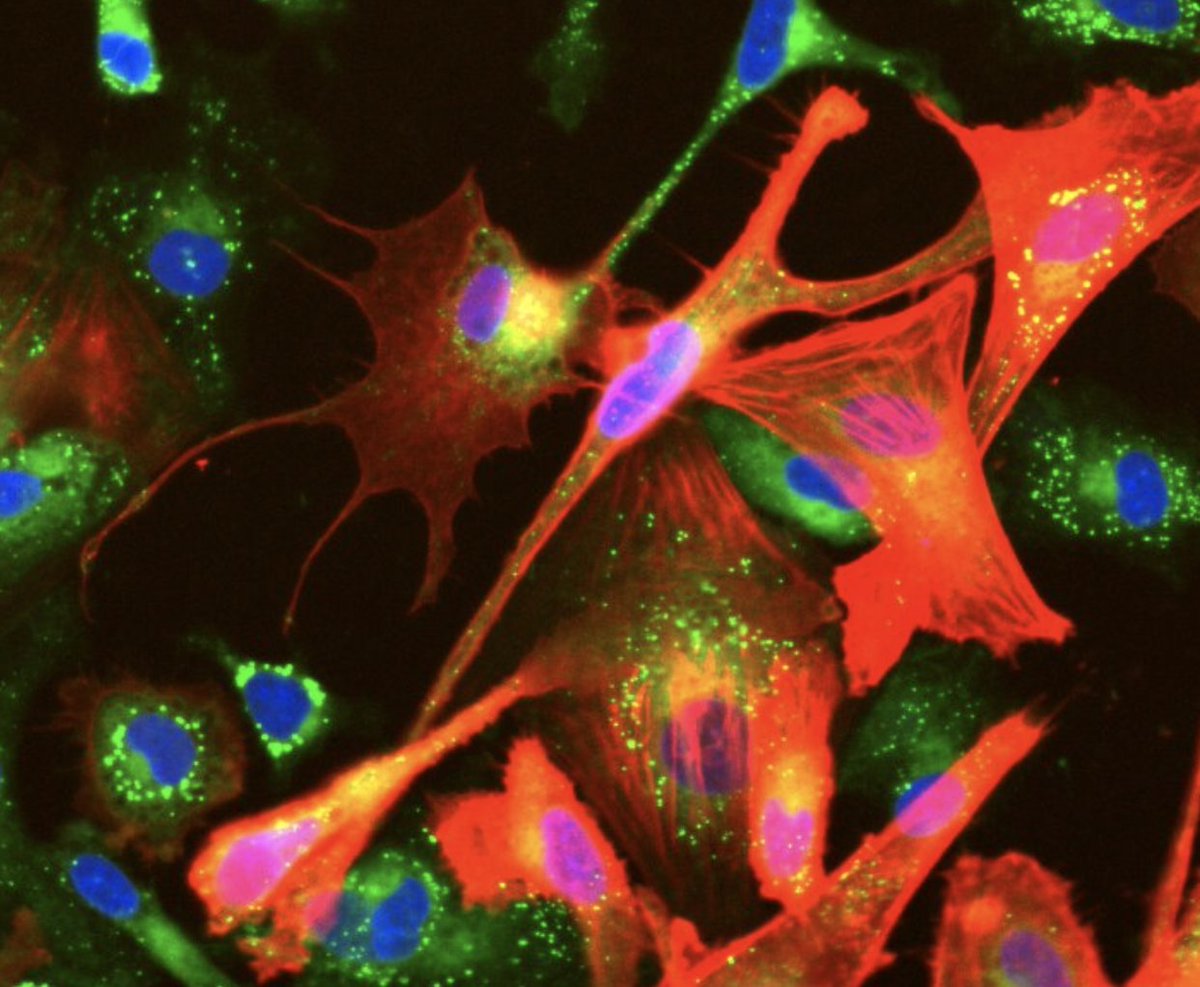 AmandaKMcQuade's tweet photo. Happy Fluorescence Friday to these lipid-loaded microglia! SciShots: The brain’s mysterious, multipurpose immune system https://t.co/oTER03m2yi https://t.co/HzkGVn07mW