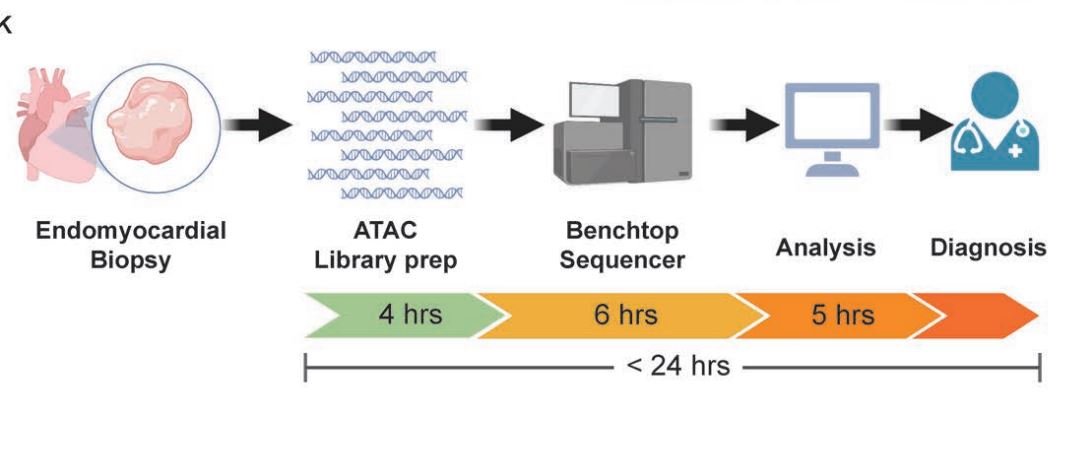 Circulation (@circaha) on Twitter photo #ResearchLetter: Chromatin accessibility signatures identify cardiomyopathy etiology, providing a molecular diagnosis that has potential to improve accuracy of cardiomyopathy classification <a href="/SamBhattachary3/">Sam BhattacharyyaPhD</a> #AHAJournals ahajrnls.org/3UbZaRf #ResearchLetter: Chromatin accessibility signatures identify cardiomyopathy etiology, providing a molecular diagnosis that has potential to improve accuracy of cardiomyopathy classification <a href="/SamBhattachary3/">Sam BhattacharyyaPhD</a> #AHAJournals ahajrnls.org/3UbZaRf