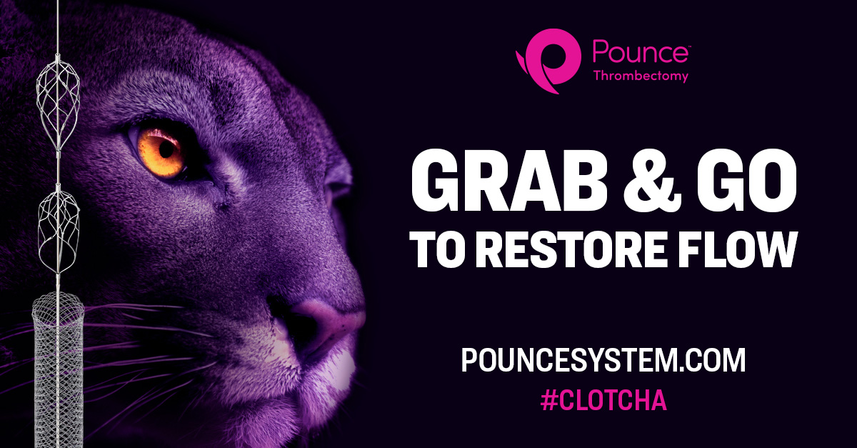 Surmodics's tweet photo. If you’re tired of setting up capital equipment for #thrombectomy procedures, make the Pounce™ Thrombectomy System your first-line, grab-and-go tool for quickly restoring blood flow. Hungry for more? See this remarkable device at https://t.co/DuZYW6ViFD. Rx only. #Clotcha #IRad https://t.co/VpjScC9WNV