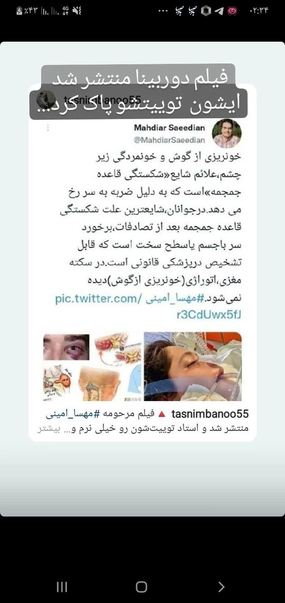 mo_hammad1378's tweet photo. وقتی سواد رسانه در بین مردم ناشناس  باشد موج سواری غربگرایان تا خود انقلابیون خواهد بود .
بعد از پخش  شدن فیلم #مهسا_امینی 👇 https://t.co/DbuBbpf2UW