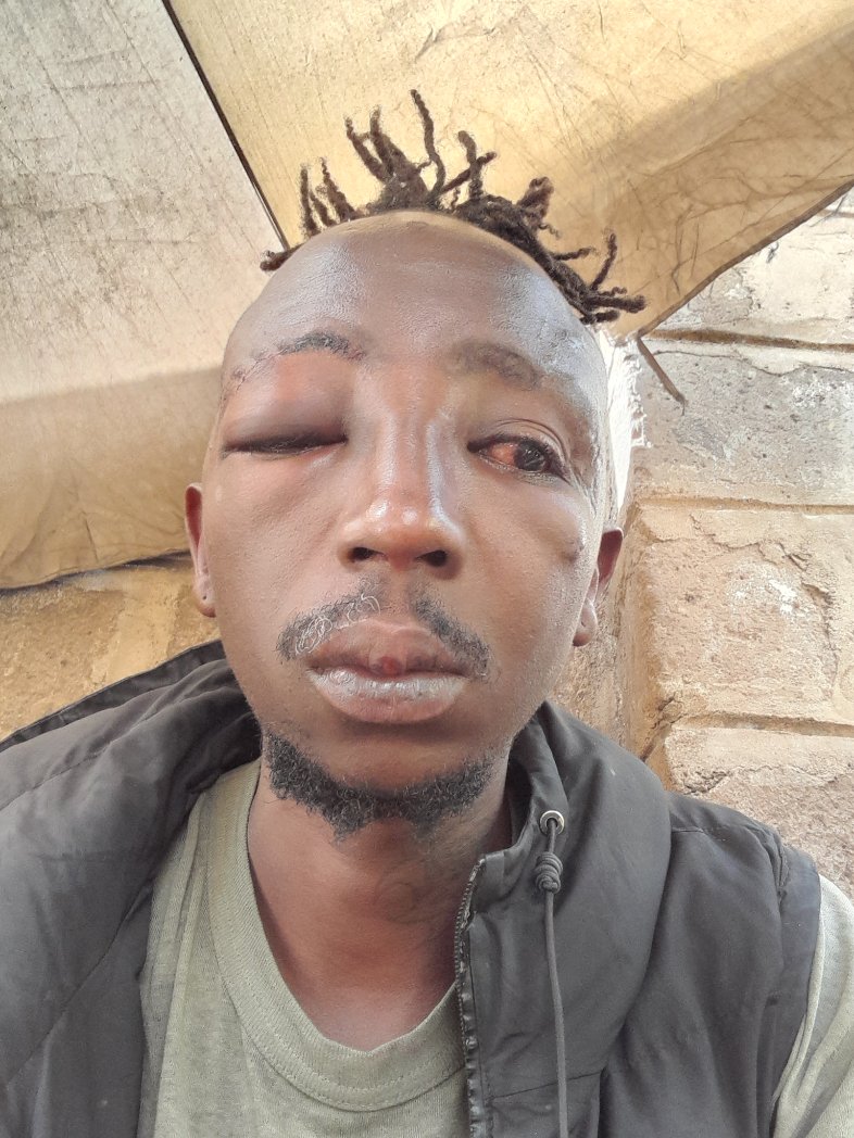 Thanks to thieves I'll be offline for a while.really in pain