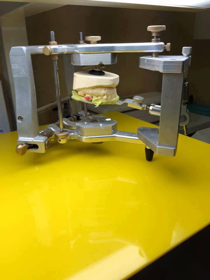E' sembrato sempre un sogno irrealizzabile poter costruire protesi con un ARTICOLATORE dalla mobilità esclusivamente Mandibolare...Oggi c'è ed è presente in tantissimi Laboratori del mondo...L'ARTICOLATORE Rainieri...!! 👍✌️