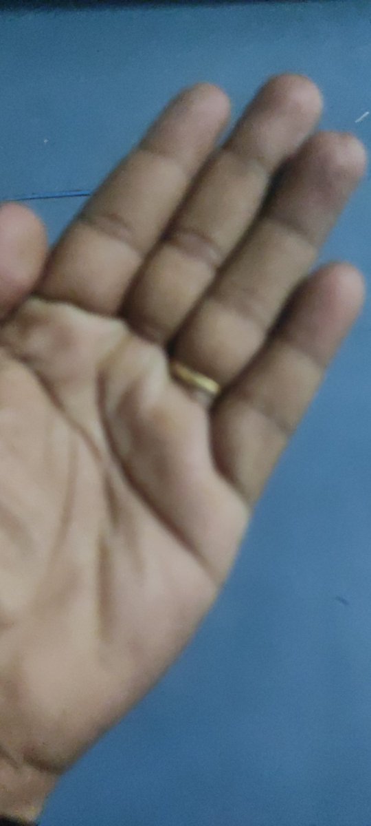imsv_22's tweet photo. @RedmiIndia my redmi note 10 pro miui 13.0.5 update after main camera Blury pictures cant focus on closeup shots and cant scan QR code @RedmiIndia @XiaomiIndia https://t.co/t5ZpD6IEoC