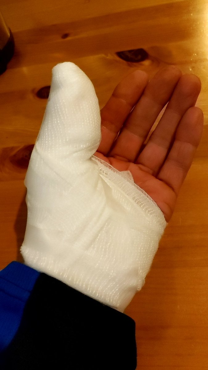 orangeflagceo_m's tweet photo. ナタデココを【閲覧可能】
庭木伐採中の出来事。
戦場では負傷した際どうしていたのかと思う。
大丈夫です。不死身なので。 https://t.co/X67GKO8FQX