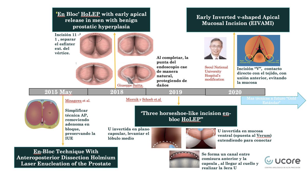 DR CARVAJAL (@romancarvajal) on Twitter photo Así la historia de nuestra querida #HoLEP, pueden enriquecer esta visual linea del tiempo si lo desean. <a href="/lfredosanchez/">Alfredo Sanchez Urólogo</a> <a href="/jfunkmd/">Joel Funk MD FACS</a> <a href="/FCAFigueiredo/">Felipe Figueiredo HoLEP 🇧🇷</a> @GoumasUrologia <a href="/MSGONZALEZURO/">Mariano Sebastian Gonzalez</a> <a href="/drglezb/">drglezb</a> <a href="/IvanMichelM/">Ivan Michel</a> Así la historia de nuestra querida #HoLEP, pueden enriquecer esta visual linea del tiempo si lo desean. <a href="/lfredosanchez/">Alfredo Sanchez Urólogo</a> <a href="/jfunkmd/">Joel Funk MD FACS</a> <a href="/FCAFigueiredo/">Felipe Figueiredo HoLEP 🇧🇷</a> @GoumasUrologia <a href="/MSGONZALEZURO/">Mariano Sebastian Gonzalez</a> <a href="/drglezb/">drglezb</a> <a href="/IvanMichelM/">Ivan Michel</a>