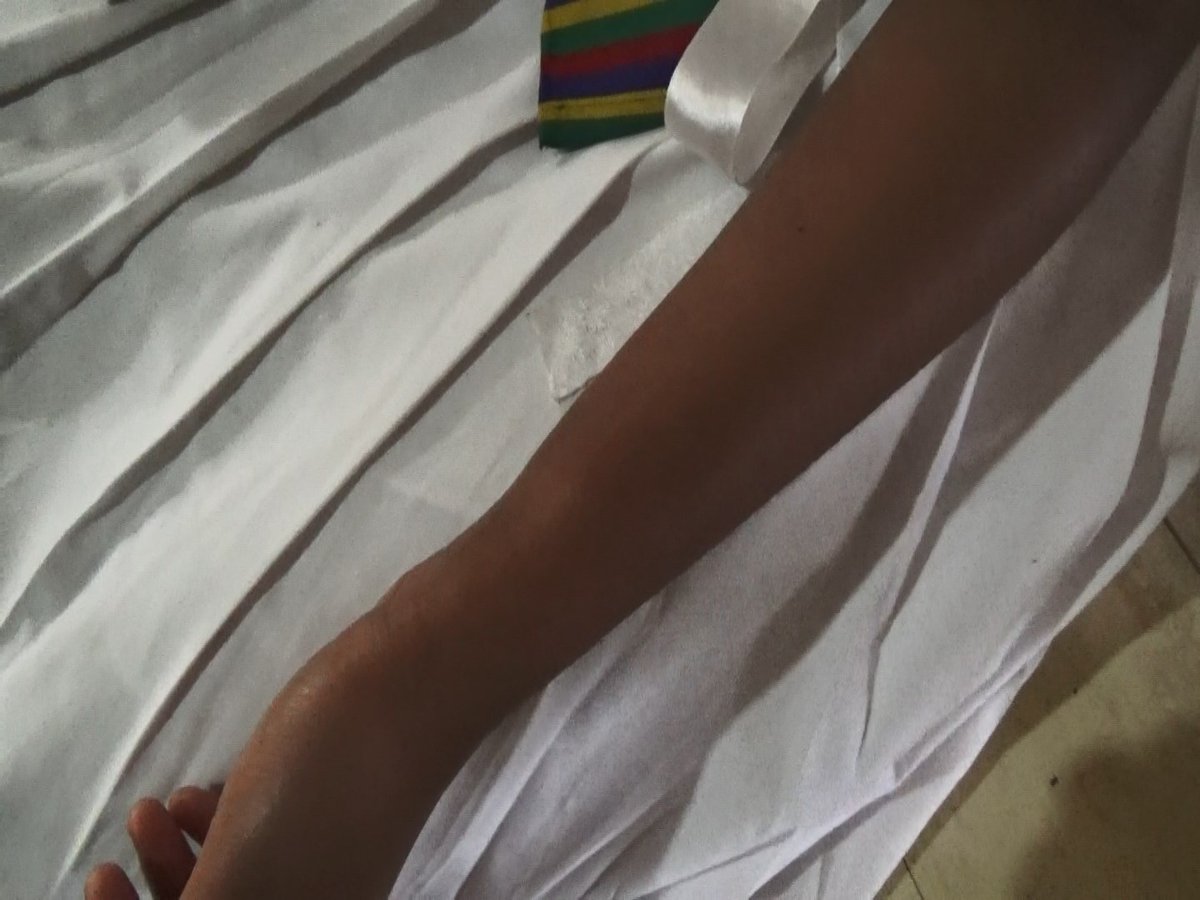mdlucias's tweet photo. A student being admitted to hospital with critically injured after the Principal brutally attacked her because she did not give 300 rs for teachers day party. incident took place at #Kotagala #Bogahawatta areia.

#Srilanka #lka #SriLankaCrisis https://t.co/BdPfokyjsG
