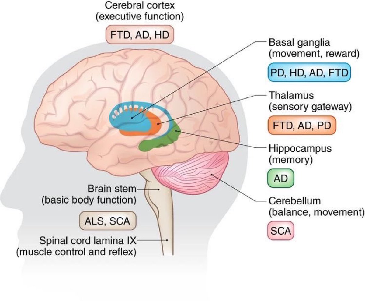 DrPharmDMDTh's tweet photo. Basic primer on brain structures impacted in neuro degenerative diseases. #neuroscience #Neurology #Neurosurgery #ClinicalPearl #clinicaltip #MedStudentTwitter https://t.co/MhsY1yV7e0