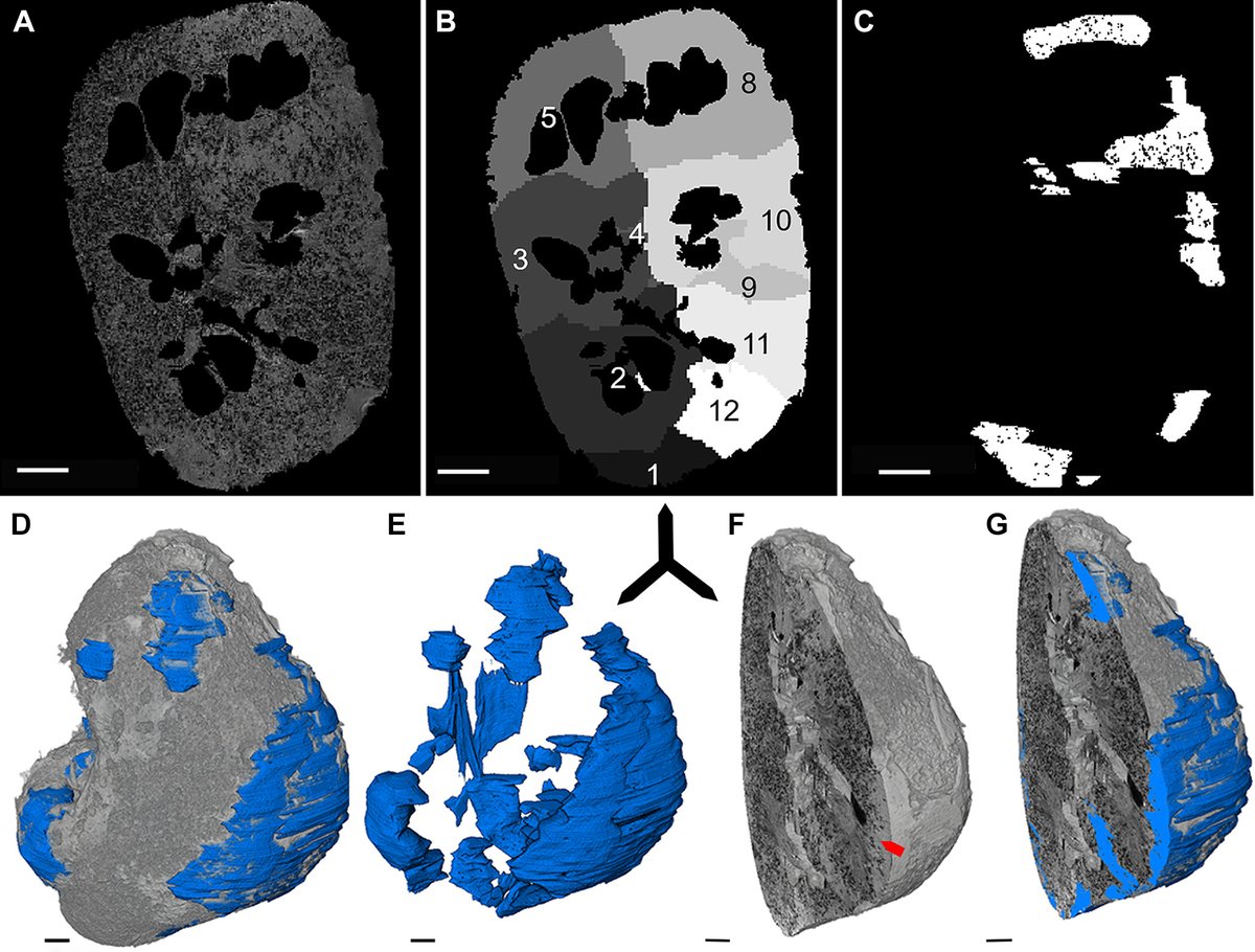 AJP Renal (@ajprenal) on Twitter photo 📷 Figure 3. Visualization of “empty regions” of nephron loss.
By: Jennifer R. Charlton, et al.
ow.ly/aR7050KW9zx
#AJPRenal #GlomerularDensity <a href="/JenniferCharlt7/">Jennifer Charlton</a> <a href="/DEddie_B/">Edwin Baldelomar</a> <a href="/MIRimaging/">WashUMedMIR</a>
#ImageOfTheWeek 📷 Figure 3. Visualization of “empty regions” of nephron loss.
By: Jennifer R. Charlton, et al.
ow.ly/aR7050KW9zx
#AJPRenal #GlomerularDensity <a href="/JenniferCharlt7/">Jennifer Charlton</a> <a href="/DEddie_B/">Edwin Baldelomar</a> <a href="/MIRimaging/">WashUMedMIR</a>
#ImageOfTheWeek