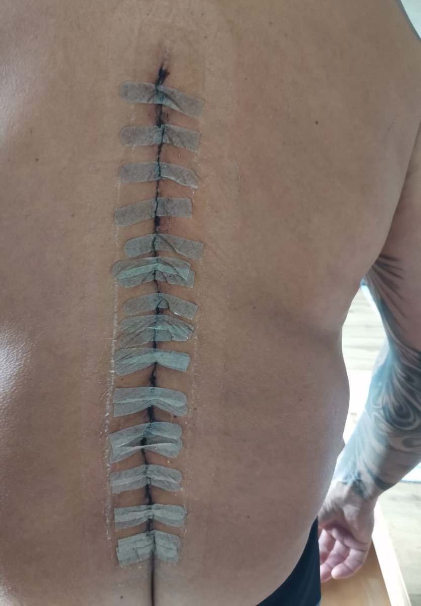klug1768's tweet photo. Hallo meine Twitter Freunde bin nach mehrstündigen OP 
einigermaßen wieder fit...
Danke  für eure Unterstützung.  LG.REINI https://t.co/ehw6UF65TR