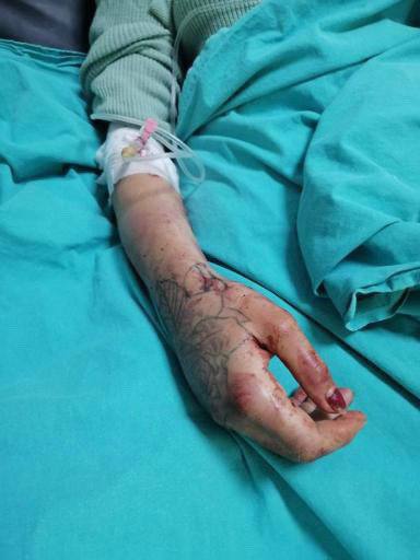 muhendisyenn's tweet photo. Mersin’de Hasan Sevincer, bir kadının üzerine bıçakla ile kazıyıp simge yapmış, yetmemiş bezybol sopasıyla saatlerce öldüresiye dövmüş ve en son cinsel istismarda bulunmuş, üstüne defalarca bıçaklamış! Ve öldü diyerek orada bırakmış. Cinayet

#HasanSevincerTUTUKLANSIN https://t.co/BYWXO6PZGJ