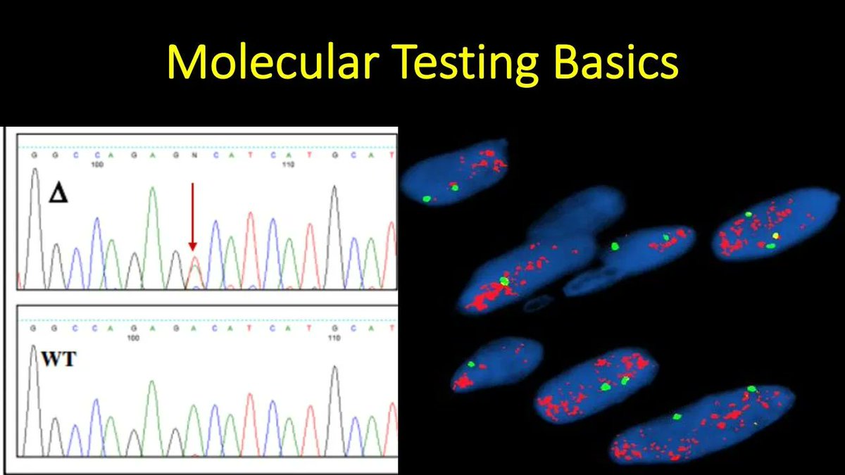 Molecular Testing Basics explained in 15 minutes (video): kikoxp.com/posts/14064. A simple explanation of the main types of molecular tests #pathologists use, when we use them, &amp; why. #pathology #pathTwitter #MedTwitter #MedEd #MolPath #dermtwitter #dermpath