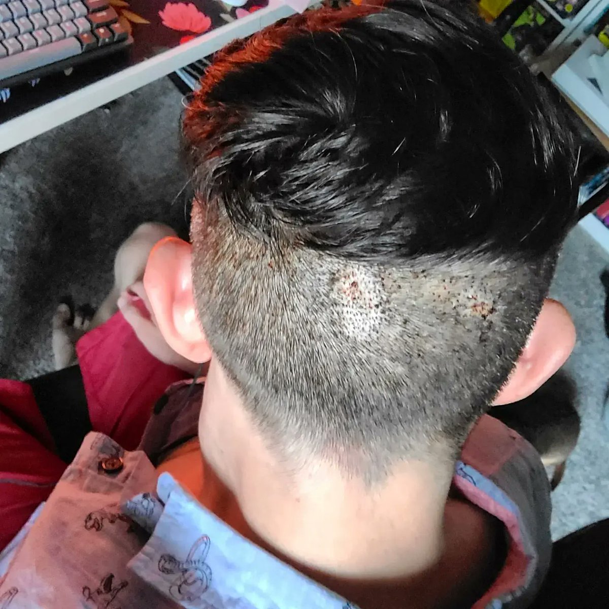 LuckyJoeJoe's tweet photo. [[Personal Story Time]] I was in a near fatal car accident back in 2001, causing skull trauma, which led to me having my head operated on. Additionally, I was in a coma for 2 weeks &amp; in the hospital for 3 months.

Luckily, I survived, but the long term ramifications (cont.) https://t.co/ZIYz2L1Ext