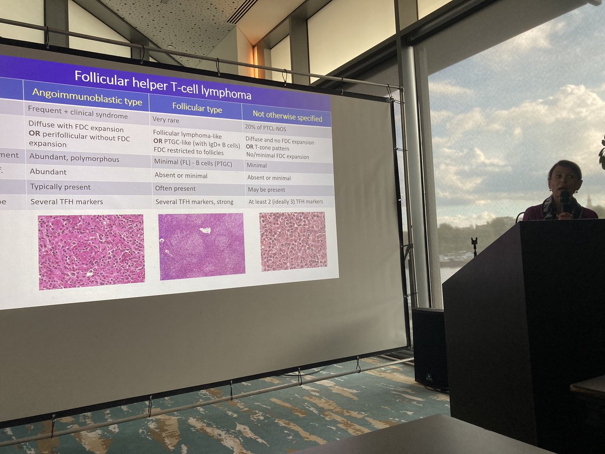 <a href="/EliLymphoma/">ELI</a> : Prof. Laurence Deleval helped us to understand the new classification of T-cell lymphoma