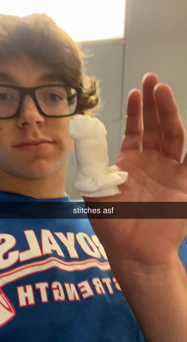 tracker_jordan's tweet photo. Jordan ego-lifted too much weight and has split his thumb open. We will see if he is ready for Hoosier Junior at Otter Creek on October 8-9th. Get better Jordan! https://t.co/vCZXxpU6hg