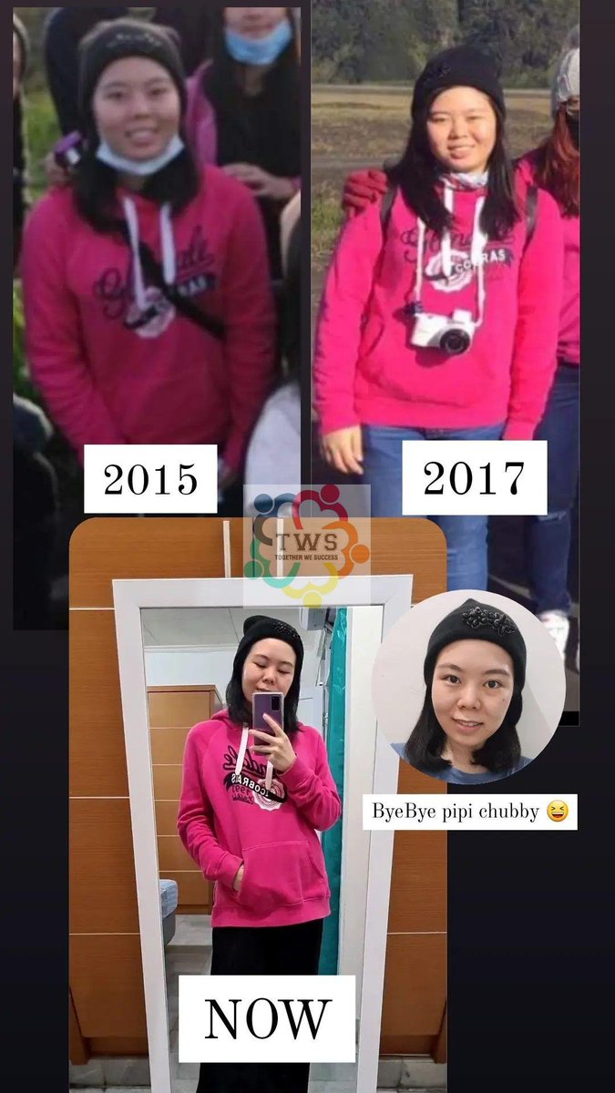 shelz_SB's tweet image. 2x pergi ke Bromo, jaman SMP dan Kuliah.
Tetep pake outfit yang sama persis.
Dulu pake baju harus yang loose.😅
Tapi sekarang, bisa dilihat sendiri, dipake jadi keliatan 'cungkring' 🙈
Byebye pipi chubby, bybye Fat 👋👋
#twsprogram #programtws
#diet #dietsehat
#healthylifestyle