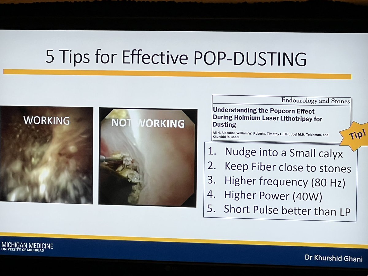 FlorianSchroeck's tweet photo. Such a treat to have @peepeeDoctor speak on LASER surgery for #urolithiasis at #NEAUA22: π ideal settings for #dusting & #popdusting π practical tips for #holmium & #thulium #LASER settings https://t.co/tyhc7I6EjJ