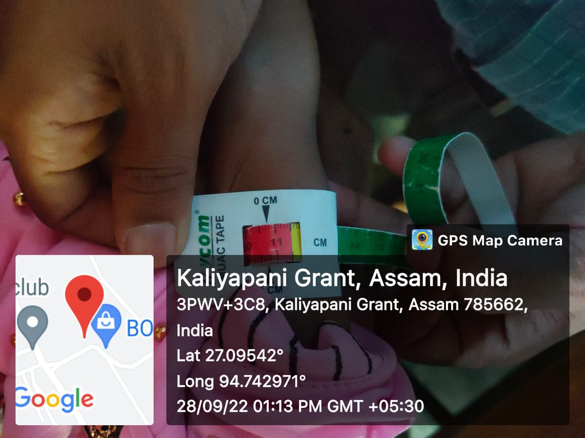 Screening at Athabari Bagan AWC.One SAM child was detected &amp; referred to Tiloi NRC by Demow MHT.<a href="/nhm_assam/">NHM_Assam</a> <a href="/dc_sivasagar/">District Commissioner, Sivasagar</a> <a href="/MoHFW_INDIA/">Ministry of Health</a> <a href="/keshab_mahanta/">Keshab Mahanta</a>