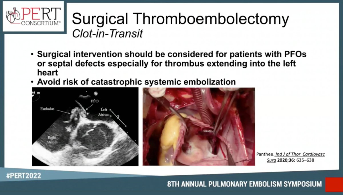 PKirupaharan's tweet photo. 🔥 Debate of percutaneous versus surgical (thrombo)embolectomy for mgmt of the dreaded CIT. @carin_gonsalves @BrentKeeling @FMaeWestMD @JeffPulmonary @JeffCVIR #PERT2022 #PERTTrainee #ClotinTransit https://t.co/CBcZpQHrqz