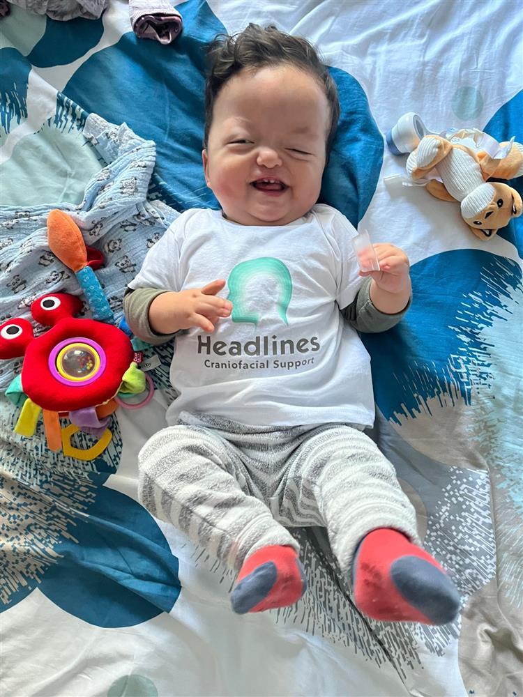 Headlines Craniofacial Support tweet media