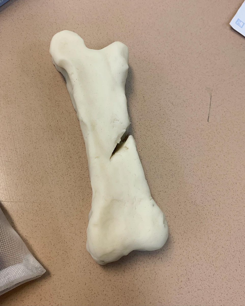 SoLee_AOLS's tweet photo. We created long bones and different types of fractures using play-doh! @leecoschoolsnc @NAFCareerAcads https://t.co/oAzoV1X8Up