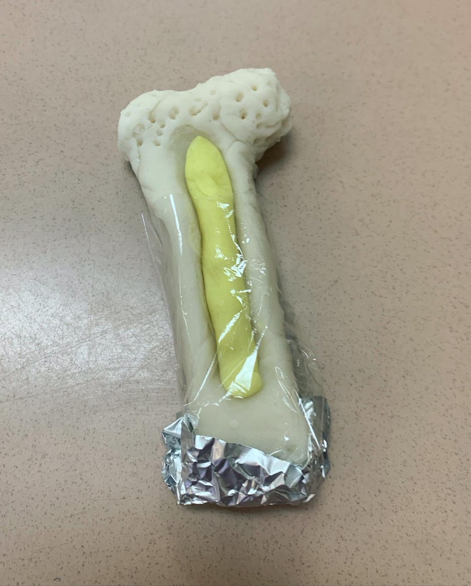 SoLee_AOLS's tweet photo. We created long bones and different types of fractures using play-doh! @leecoschoolsnc @NAFCareerAcads https://t.co/oAzoV1X8Up
