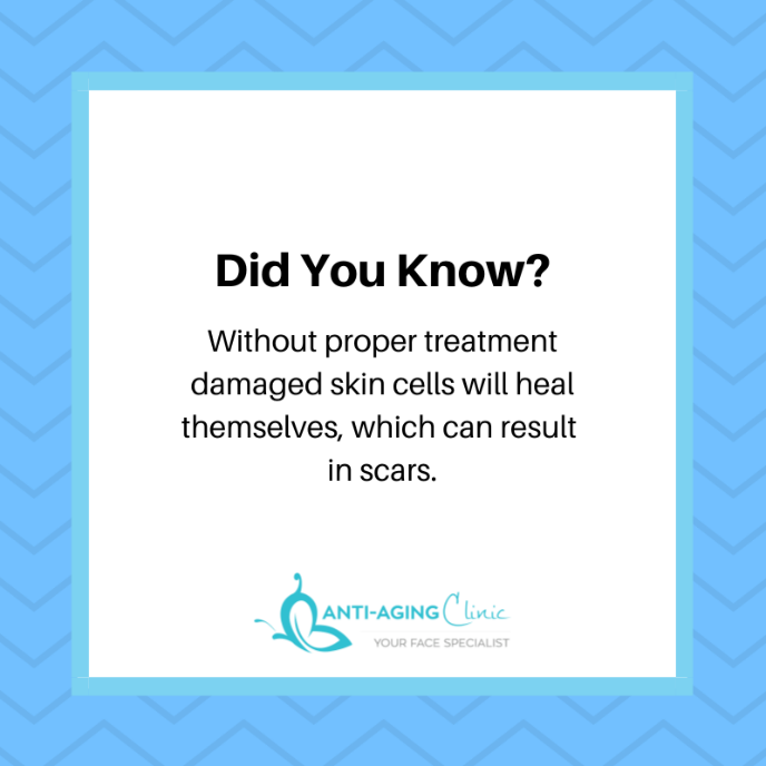 antiagingTOR's tweet photo. #Skincare #Scars #AntiAging #beauty https://t.co/keBD8043Yx
