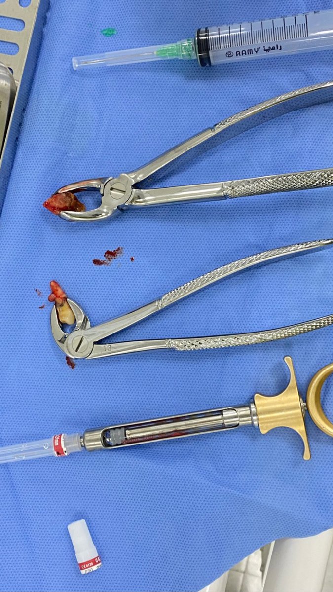 Surgery weekend 💉🩸
3rd molar &amp; 1st premolar extraction 🦷