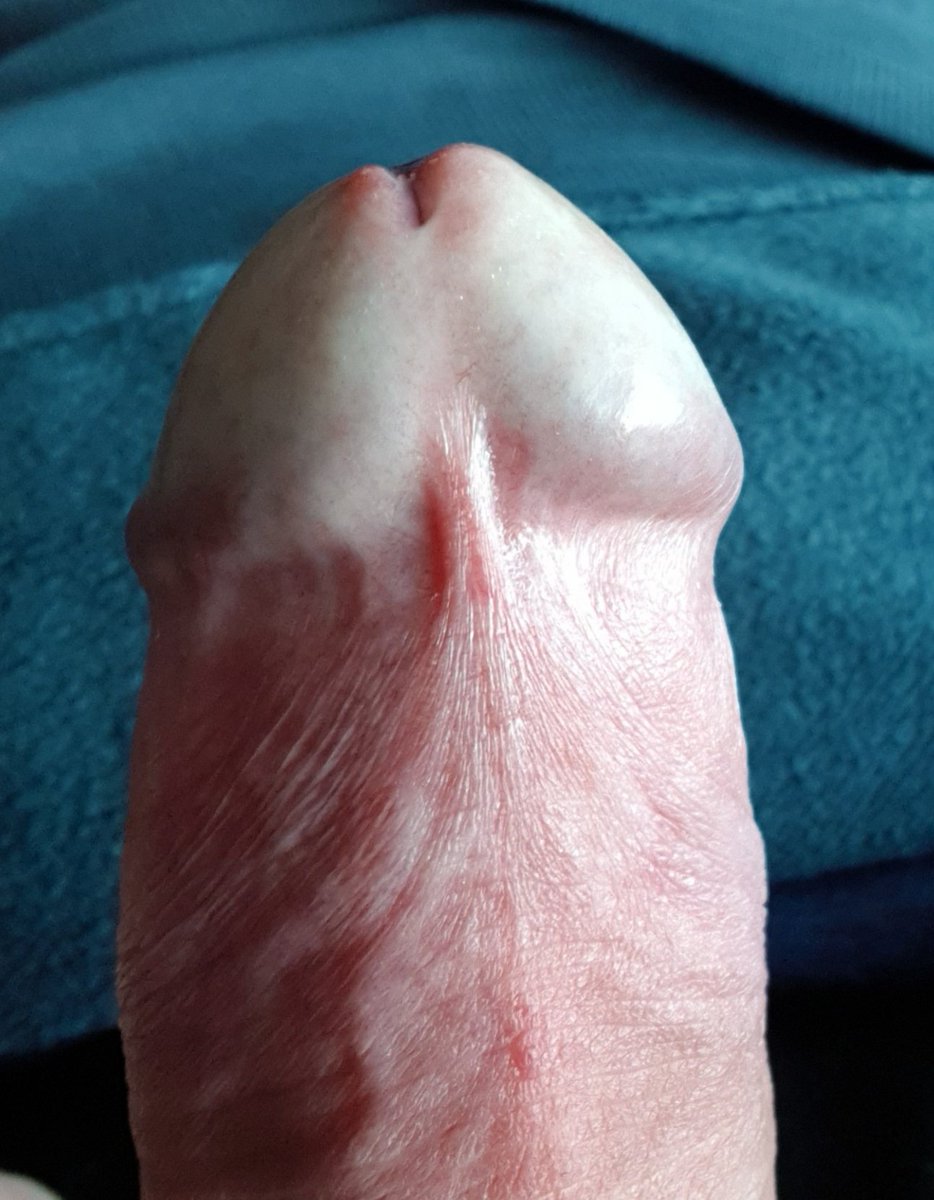 Oli30002's tweet photo. Das geilste an einem Schwanz ist das Frenulum    oder?
#gayporn #gay #star #live #gaysex 
#free #bareback #boy #teen
#cocksucker #gayxxx #clip 
#trade #nsfw #gaypornstar #twink #frenum #frenulum
#horny #cum #cock #nude #naked 
#TEENLEAKS #youngleaks 
#pornogay  
#amateur #gayhot https://t.co/J4rcnjOkVR