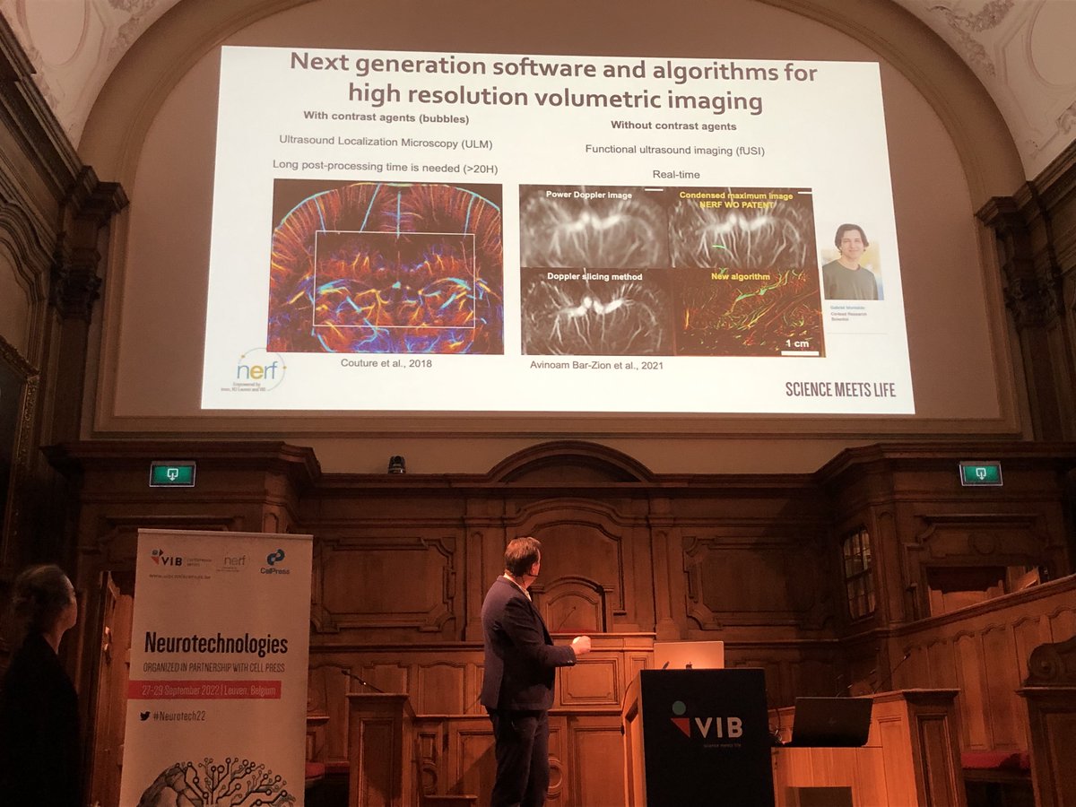 AOlivferreira's tweet photo. #Neurotech22 Day 3, @__NERF PI Alan Urban @fUSI_brain_imag walked us through the R&D of functional ultrasound imaging technology - fUSI.
There is a bright future for brain-wide volumetric imaging! #VIB https://t.co/xB8ABdo1II