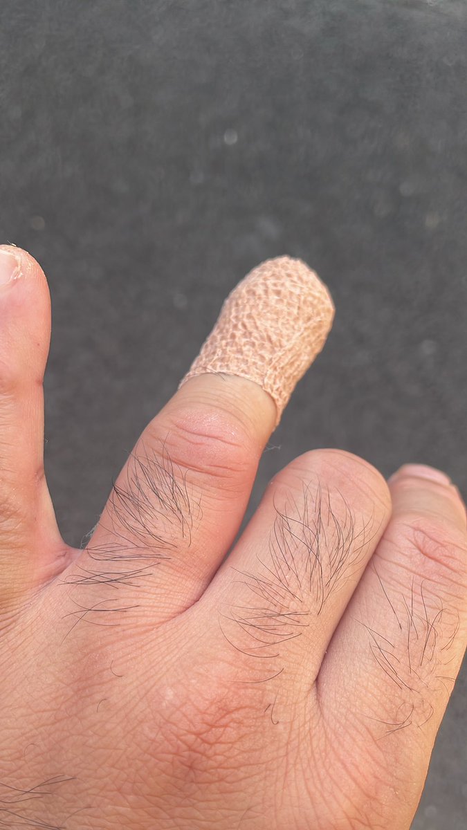 ササクレから指先が化膿して、陥入爪みたいなって治りが悪いので、麻酔打たれて爪剥がした…#なんて日だ