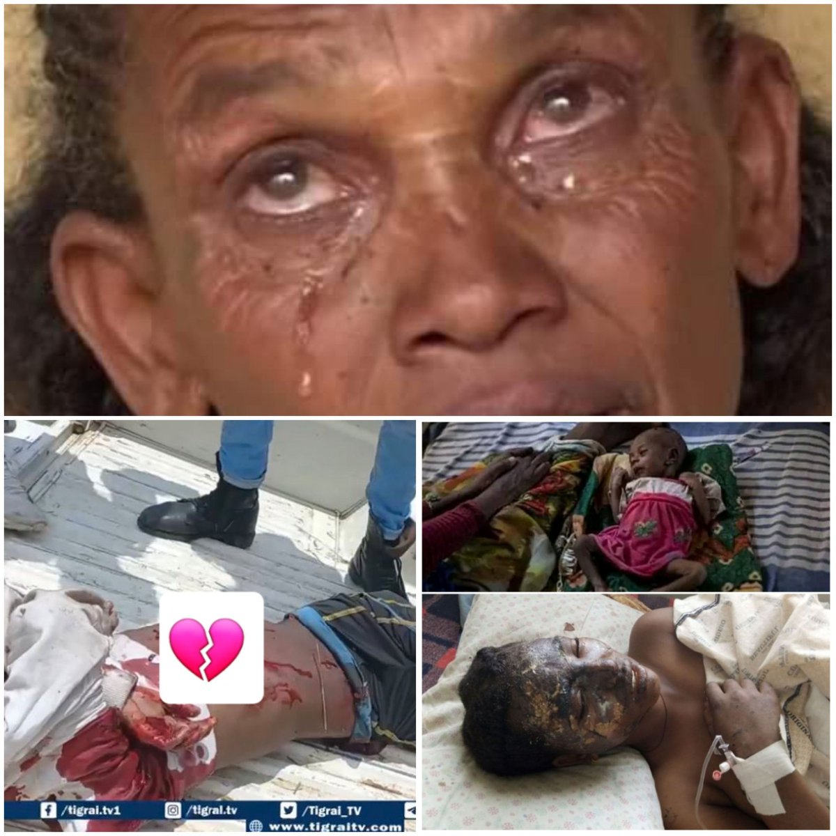 Day 694:#TigrayGenocide💔💔💔 
Tigray is in dark
Tigray is suffering
Tigray is bleeding
Tigray is unde siege 
#TigrayIsUnderAttack 
#StopBombingTigray 
#StopWarOnTigray 
#StopTigrayGenocide 
#EndTigraySieg 
@hrw @amnesty @UN_HRC @eu_eeas @SenateForeign @SFRCdems @StateDeptSpox