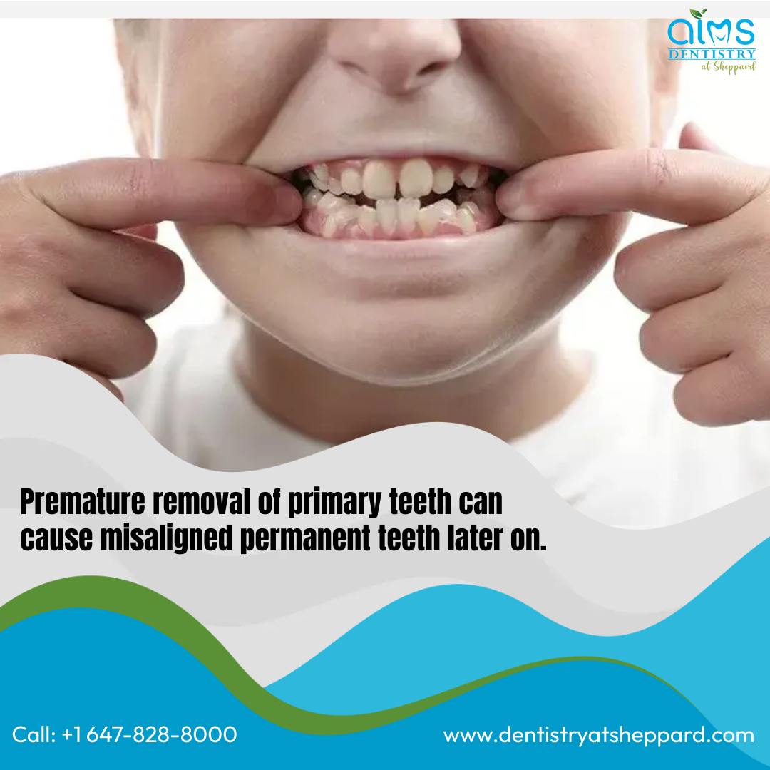 aims_sheppard's tweet photo. It's better to avoid extractions at all costs by observing good oral hygiene practices from the very start. 

#dentistry #aimsdentistrysheppard #AIMS https://t.co/0iL7xOWH9Q